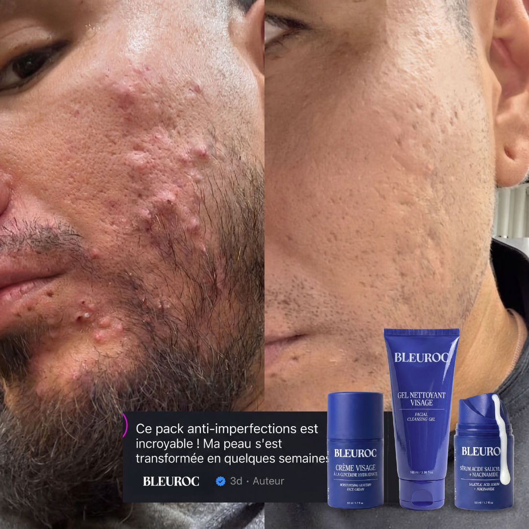 Pack Anti-Imperfections